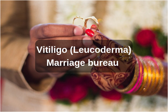Vitiligo Matrimony Solution To Vitiligo Marriage Problems 5516